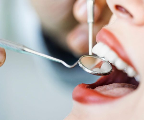 Oral Cancer Screening in Rockville