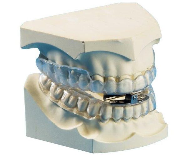Sleep Apnea Dentist in Rockville, MD