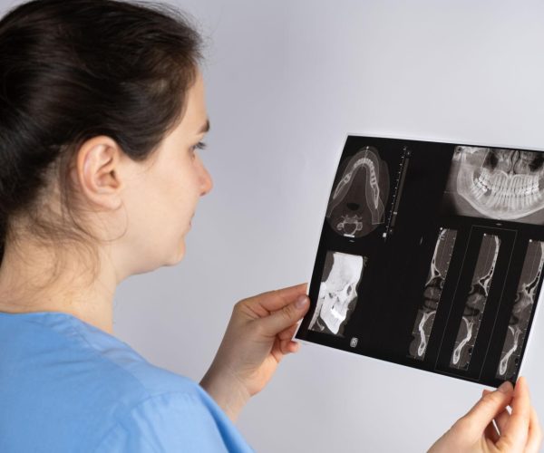 TMJ Treatment in Rockville, MD