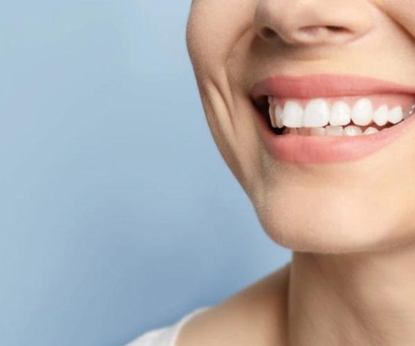 Teeth Whitening in Rockville, MD