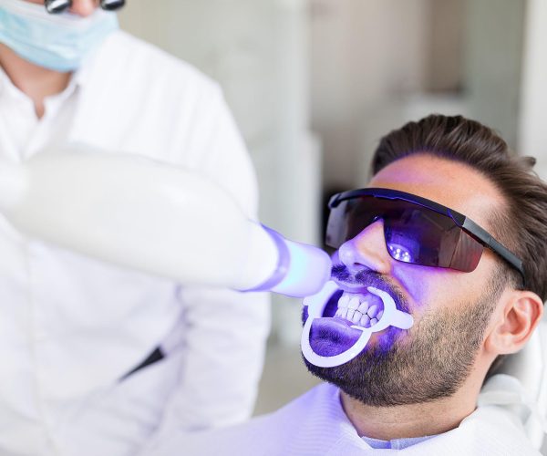 Teeth Whitening in Rockville